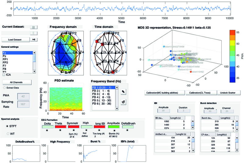 Unser Team entwickelte im Projekt »Tenecor« eine EEG-Analysesoftware. Sie ist Bestandteil eines multifunktionalen Monitoringsystems für Frühgeborene. 